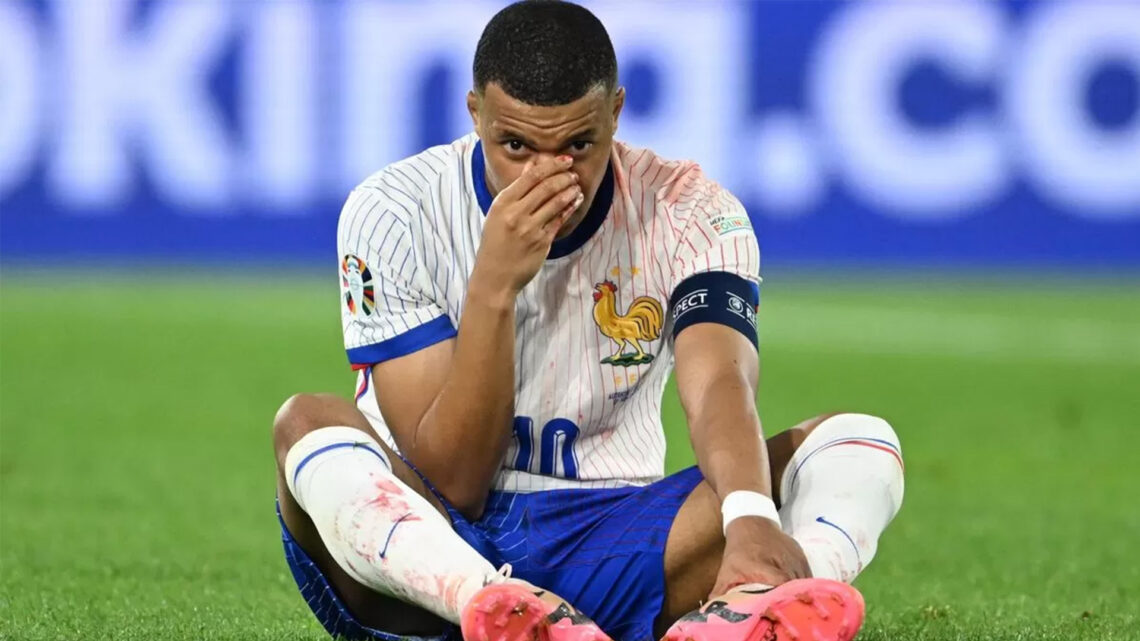 Insiden Cedera Kylian Mbappe: Keberuntungan dan Keprihatinan di Laga Prancis vs Austria EURO 2024